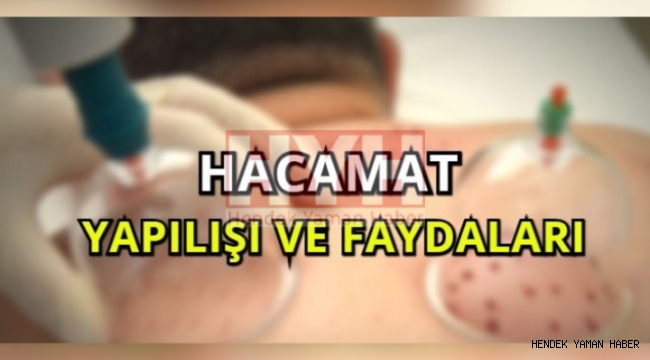 Hacamat Nedir Kimlere Yapılır
