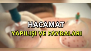 Hacamat Nedir Kimlere Yapılır 