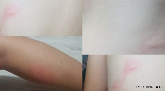 Hendek Yeşilköy'de  Sivrisinek Vatandaşın Kabusu Olmaya Devam Ediyor