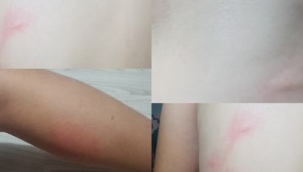 Hendek Yeşilköy'de  Sivrisinek Vatandaşın Kabusu Olmaya Devam Ediyor