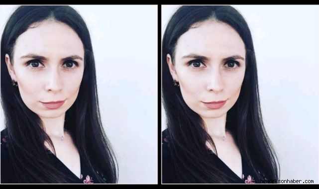 Genç Yaşında Amansız Hastalığa Yenildi